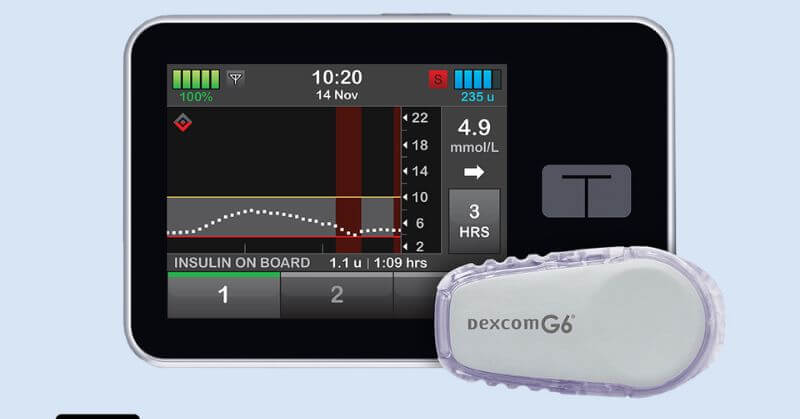 Basal IQ Technology