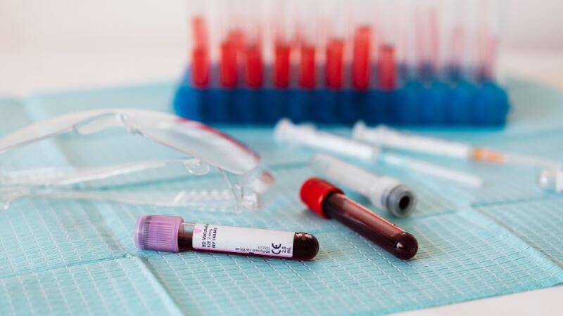 Blood samples