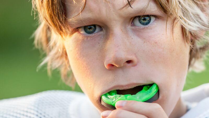 Mouthguards