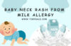 baby neck rash from milk