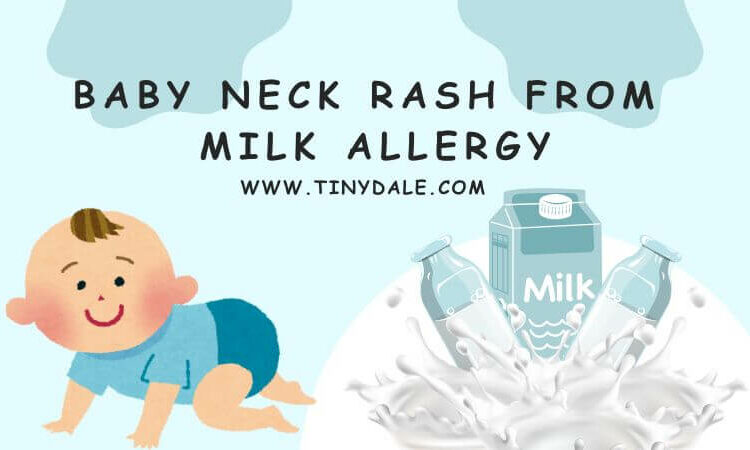 baby neck rash from milk