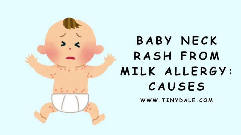 baby neck rash from milk causes