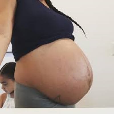 Baby dropping belly picture