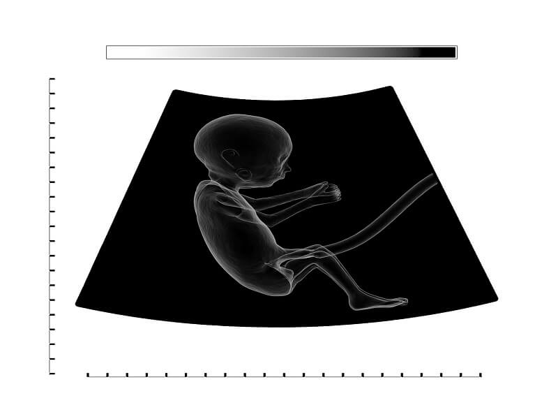 Baby growth in first 12 weeks