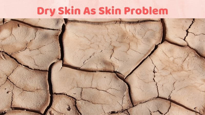 Dry Skin As Skin Problem