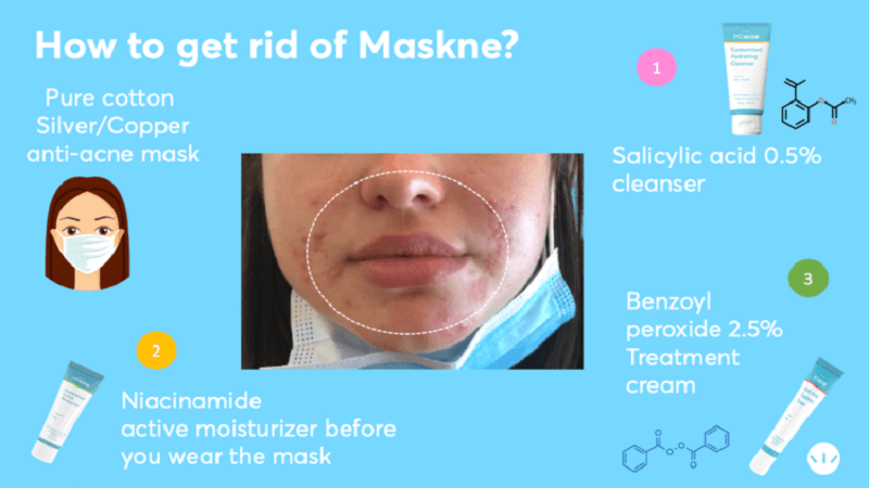 Maskne treatment