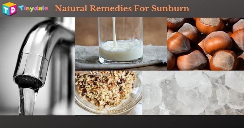 Natural remedies for sunburn