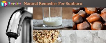 Natural Remedies for Sunburn