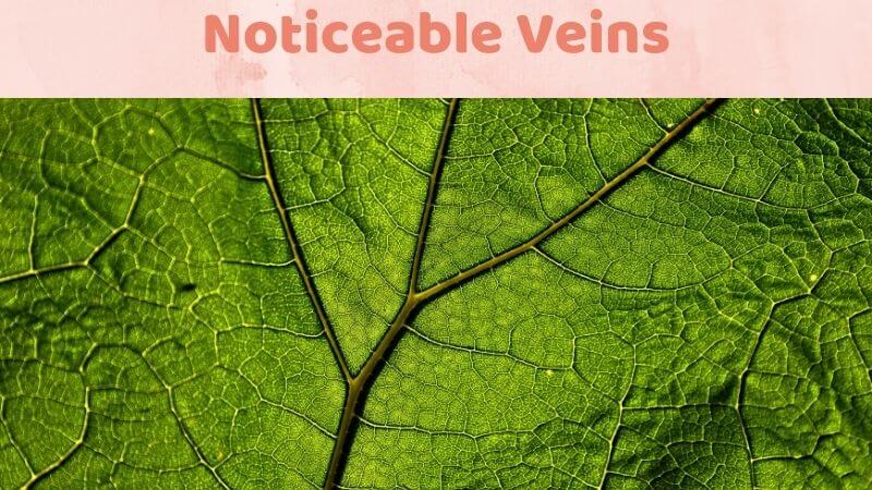 Noticeable Veins