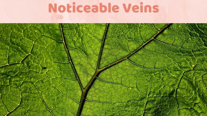 Noticeable Veins