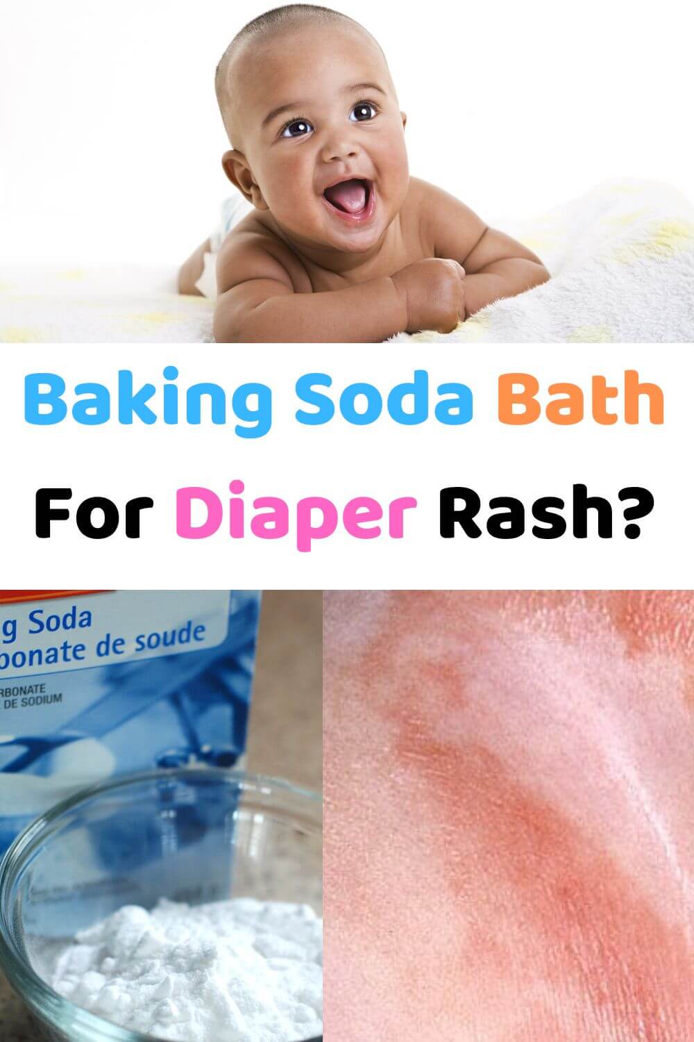 How Effective Is Baking Soda Bath For Diaper Rash?