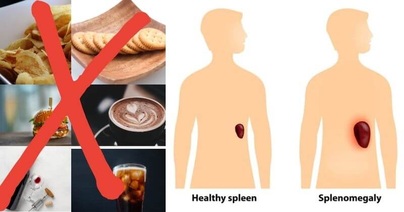 foods to avoid with enlarged spleen