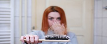 Hair loss post pregnancy