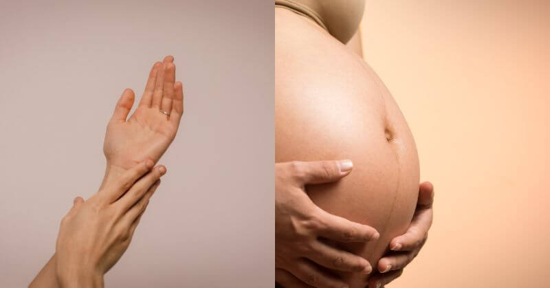 laser hair removal in pregnancy