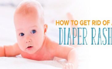 How to treat diaper rash