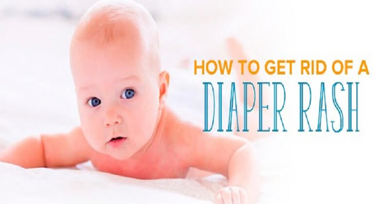 How to treat diaper rash